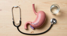 Long Covid May Physically Damage the Nerves That Control the Stomach