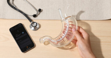 Long Covid May Physically Damage The Nerves That Control The Stomach