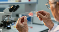 Scientists may have finally found how Alzheimer's spreads through the brain