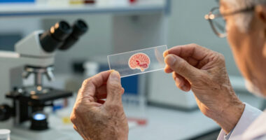 Scientists may have finally found how Alzheimer's spreads through the brain